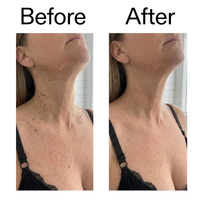 Belvora smoothing Glycolic Acid Body Stick