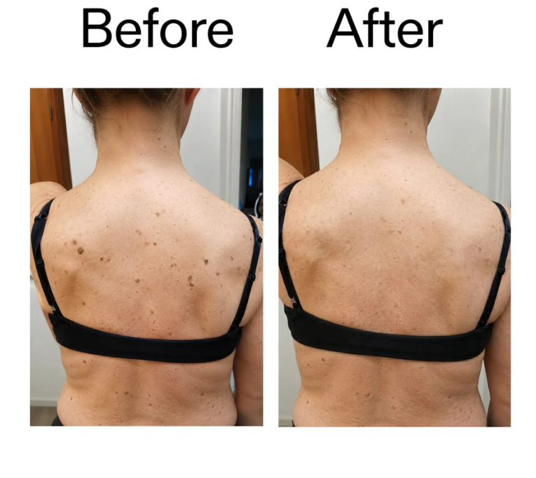 Belvora smoothing Glycolic Acid Body Stick