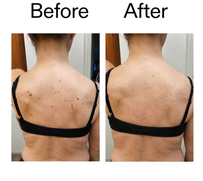 Belvora smoothing Glycolic Acid Body Stick