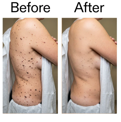 Belvora smoothing Glycolic Acid Body Stick