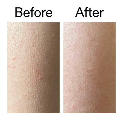 Belvora smoothing Glycolic Acid Body Stick