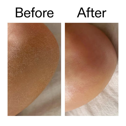 Belvora smoothing Glycolic Acid Body Stick